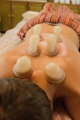 baňkování baňkování